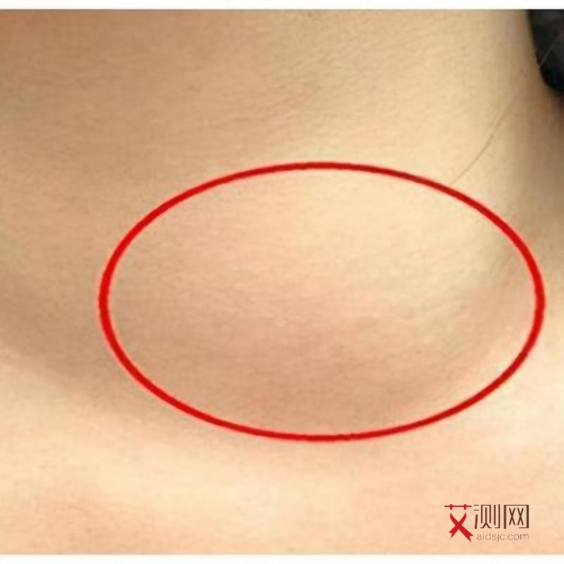 艾滋病的表现是什么样的症状呢女性