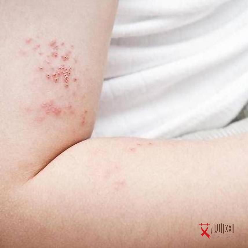 女生得艾滋的几率是多少