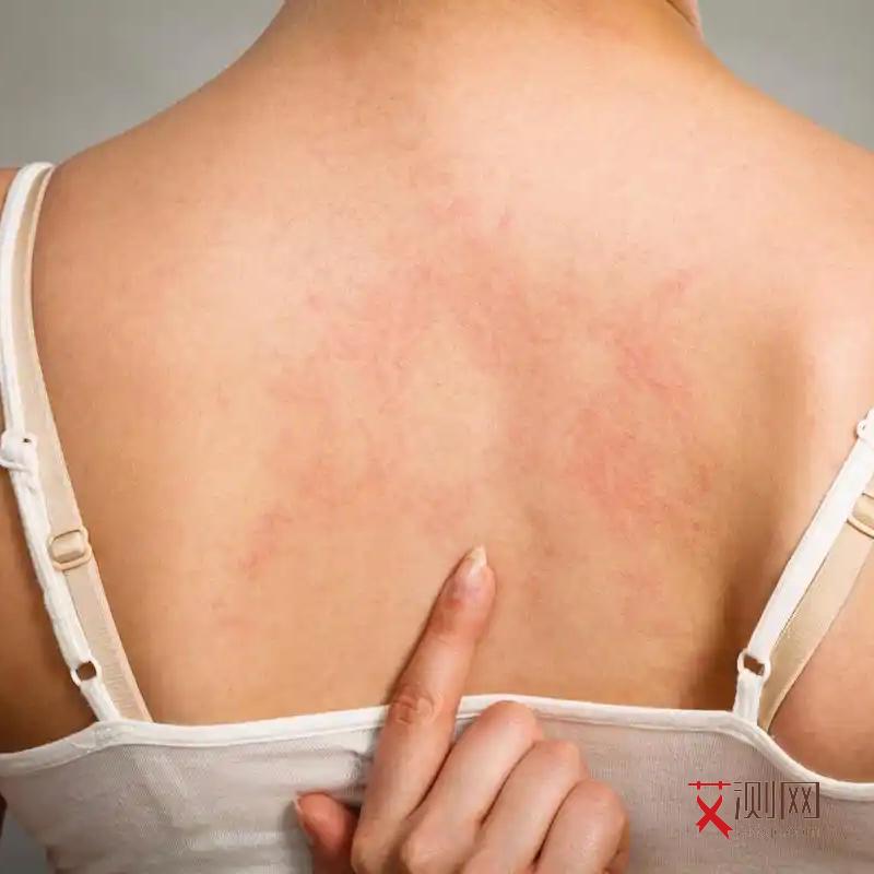 男性如何检查自己有没有感染艾滋病