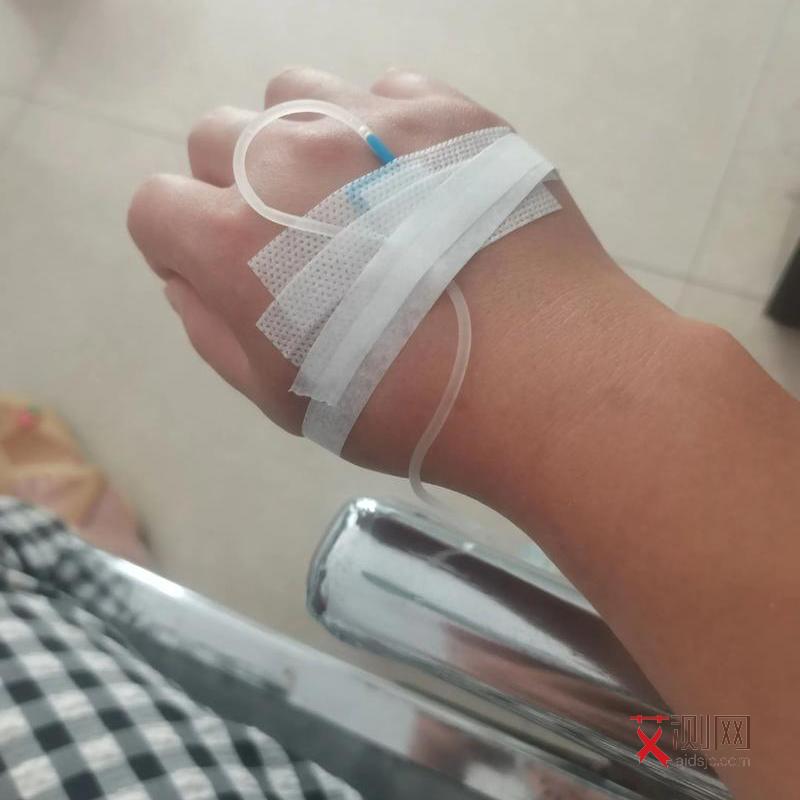 艾滋初期长的痘什么样