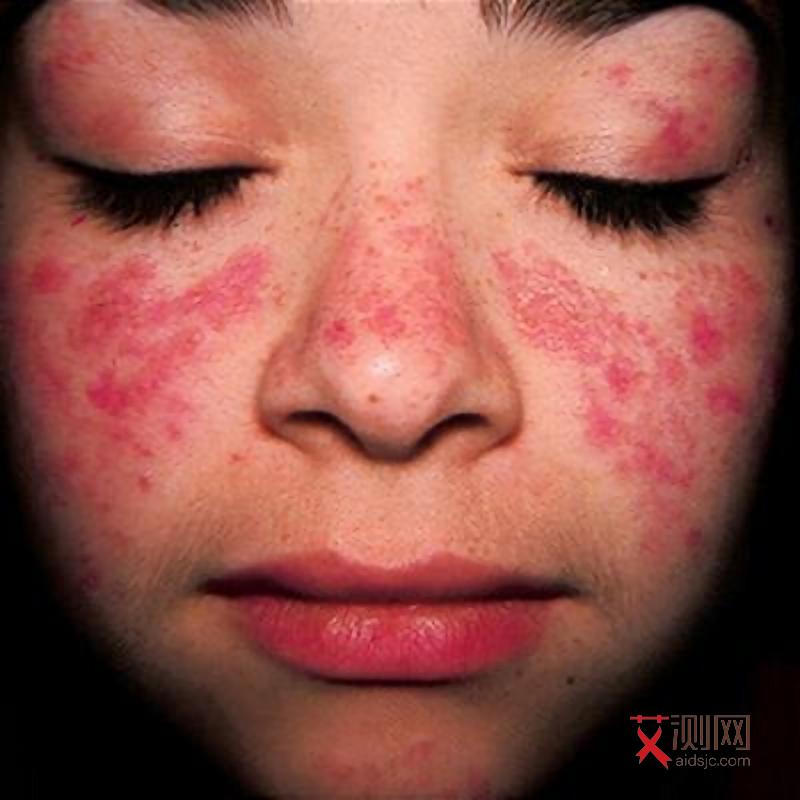 怎样看男的有没有艾滋病毒呢