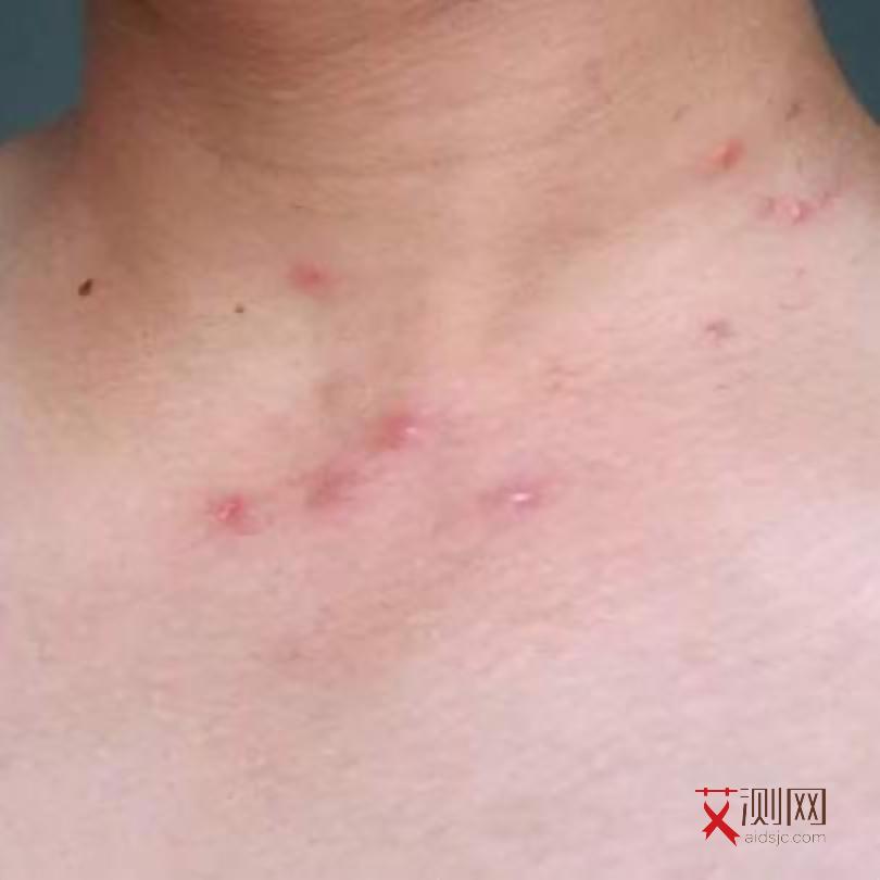 艾滋会导致月经异常吗会怀孕吗