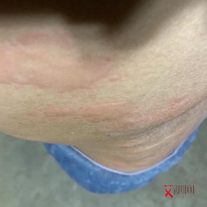 检查自己有没有艾滋病挂什么科