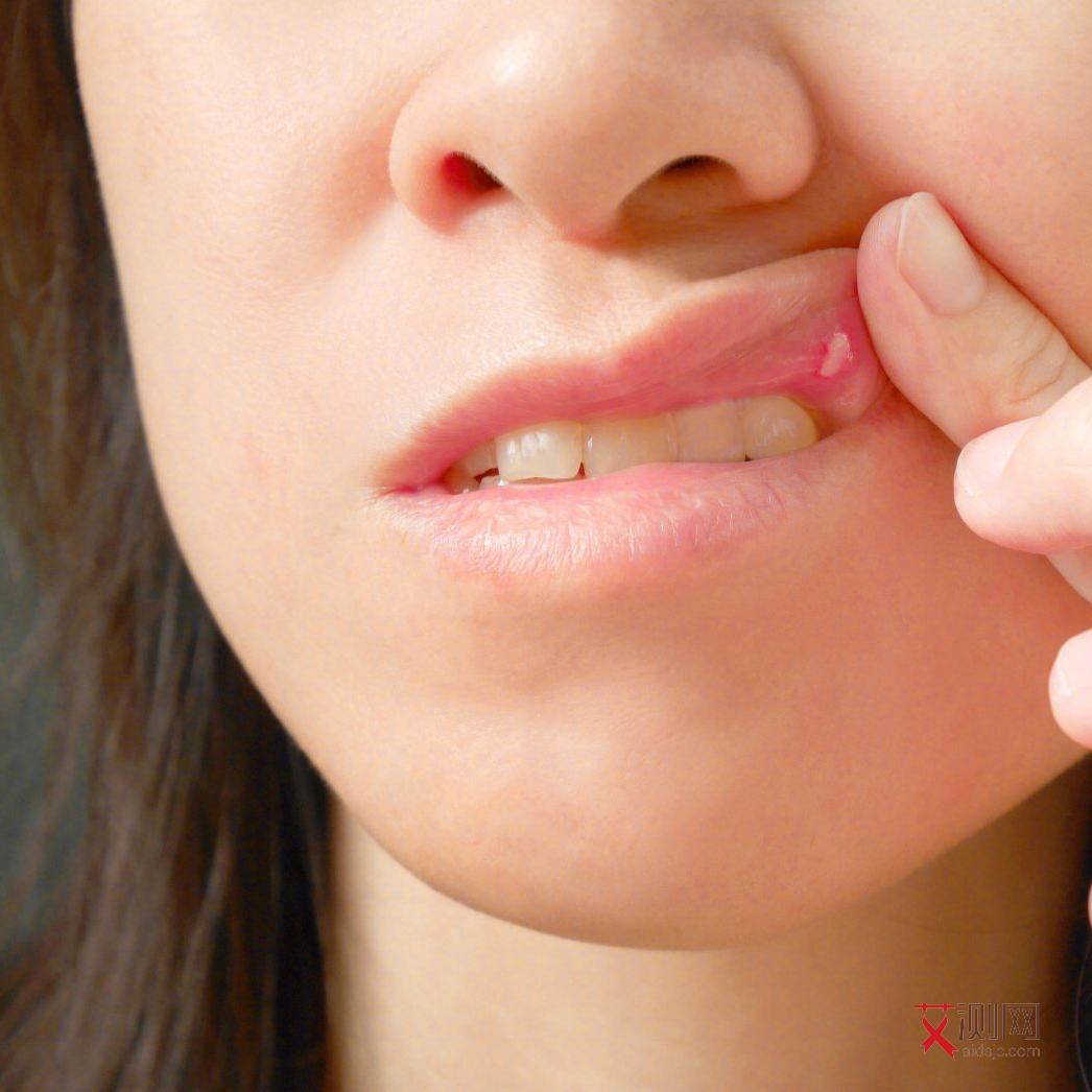 艾滋病早期有哪些症状图片男性女性