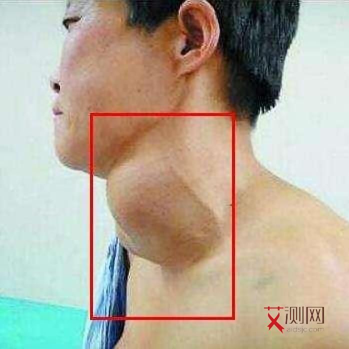 检查自己有没有艾滋病挂什么科