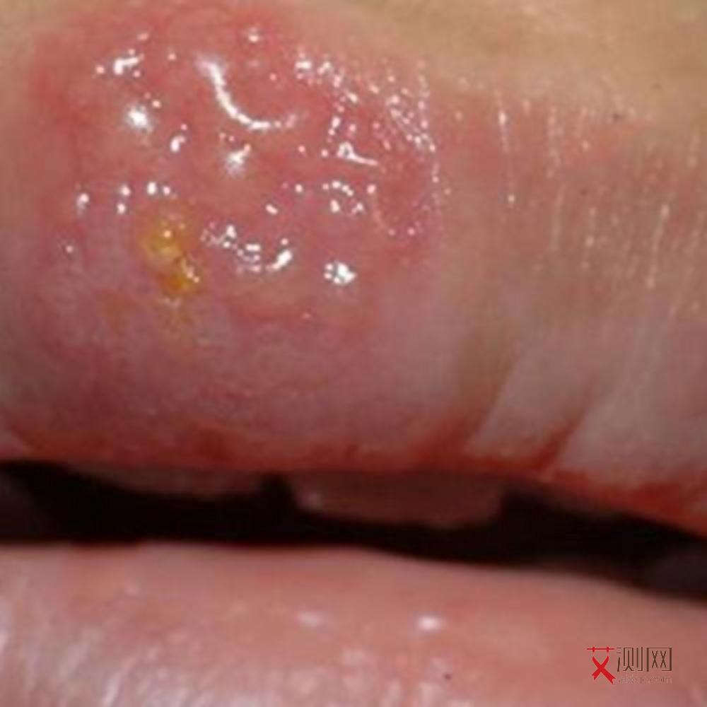 女性有没有艾滋病怎么看