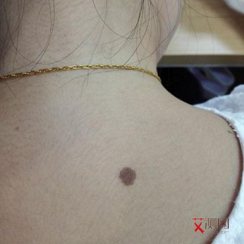 艾滋病下面会不会有异味呢图片大全